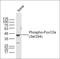 Phospholipase C Gamma 1 antibody, orb6046, Biorbyt, Western Blot image 