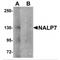 NLR Family Pyrin Domain Containing 7 antibody, MBS150857, MyBioSource, Western Blot image 