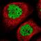 Aprataxin And PNKP Like Factor antibody, PA5-57001, Invitrogen Antibodies, Immunofluorescence image 