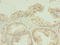 Transmembrane Protein 141 antibody, LS-C370433, Lifespan Biosciences, Immunohistochemistry paraffin image 