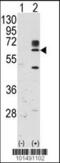 Receptor Like Tyrosine Kinase antibody, 63-134, ProSci, Western Blot image 