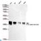Protein Phosphatase, Mg2+/Mn2+ Dependent 1B antibody, LS-C812976, Lifespan Biosciences, Western Blot image 
