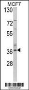 Aspartoacylase antibody, MBS9207233, MyBioSource, Western Blot image 