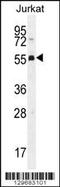 Podocan Like 1 antibody, 56-281, ProSci, Western Blot image 