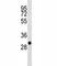 Succinate Dehydrogenase Complex Iron Sulfur Subunit B antibody, F47686-0.4ML, NSJ Bioreagents, Western Blot image 