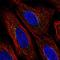 Zinc Finger Protein 469 antibody, HPA069784, Atlas Antibodies, Immunofluorescence image 