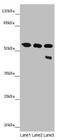 Cytochrome P450 Family 3 Subfamily A Member 43 antibody, LS-C675610, Lifespan Biosciences, Western Blot image 