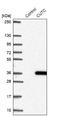 Copper homeostasis protein cutC homolog antibody, NBP1-84512, Novus Biologicals, Western Blot image 