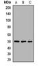 MAGE Family Member A4 antibody, LS-C667899, Lifespan Biosciences, Western Blot image 