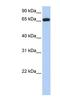 Ectonucleoside Triphosphate Diphosphohydrolase 7 antibody, NBP1-79317, Novus Biologicals, Western Blot image 