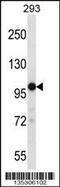 Transient Receptor Potential Cation Channel Subfamily M Member 4 antibody, 58-239, ProSci, Western Blot image 