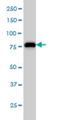 Minichromosome Maintenance Complex Component 7 antibody, H00004176-M01, Novus Biologicals, Western Blot image 