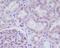 Adiponectin Receptor 1 antibody, M01869, Boster Biological Technology, Immunohistochemistry paraffin image 