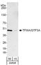 General Transcription Factor IIIA antibody, A303-621A, Bethyl Labs, Western Blot image 