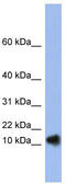 Ribonuclease A Family Member 1, Pancreatic antibody, TA345821, Origene, Western Blot image 