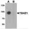 Teashirt Zinc Finger Homeobox 1 antibody, MBS150495, MyBioSource, Western Blot image 