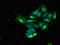 Insulin Receptor antibody, LS-C678359, Lifespan Biosciences, Immunofluorescence image 