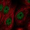 Zinc Finger And BTB Domain Containing 21 antibody, NBP2-55456, Novus Biologicals, Immunocytochemistry image 