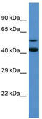 Glutamate Decarboxylase Like 1 antibody, TA342666, Origene, Western Blot image 