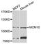 Minichromosome Maintenance 10 Replication Initiation Factor antibody, STJ29279, St John