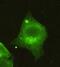 Histone Deacetylase 4 antibody, GTX49181, GeneTex, Immunofluorescence image 