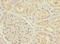 Methylenetetrahydrofolate Dehydrogenase (NADP+ Dependent) 1 Like antibody, LS-C676086, Lifespan Biosciences, Immunohistochemistry paraffin image 
