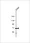 HAUS Augmin Like Complex Subunit 5 antibody, 61-845, ProSci, Western Blot image 