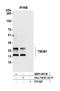 Transmembrane And Ubiquitin Like Domain Containing 1 antibody, NBP2-59138, Novus Biologicals, Western Blot image 