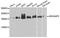 Rho GTPase Activating Protein 5 antibody, A3587, ABclonal Technology, Western Blot image 