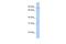 WD And Tetratricopeptide Repeats 1 antibody, A11362, Boster Biological Technology, Western Blot image 