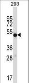 Inosine Monophosphate Dehydrogenase 1 antibody, LS-B11006, Lifespan Biosciences, Western Blot image 