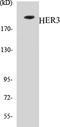 Erb-B2 Receptor Tyrosine Kinase 3 antibody, EKC1271, Boster Biological Technology, Western Blot image 