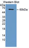 Cyclase Associated Actin Cytoskeleton Regulatory Protein 2 antibody, LS-C374685, Lifespan Biosciences, Western Blot image 