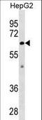 Zinc Metallopeptidase STE24 antibody, LS-C157048, Lifespan Biosciences, Western Blot image 