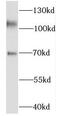 Kinesin Family Member 5C antibody, FNab04568, FineTest, Western Blot image 
