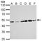 ERCC Excision Repair 8, CSA Ubiquitin Ligase Complex Subunit antibody, NBP1-32166, Novus Biologicals, Western Blot image 