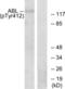 ABL Proto-Oncogene 1, Non-Receptor Tyrosine Kinase antibody, LS-C117285, Lifespan Biosciences, Western Blot image 