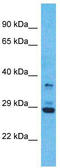 Olfactory Receptor Family 5 Subfamily V Member 1 antibody, TA337520, Origene, Western Blot image 