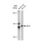 Myosin Light Chain Kinase antibody, GTX03208, GeneTex, Western Blot image 