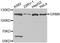 Metabotropic glutamate receptor 8 antibody, A2964, ABclonal Technology, Western Blot image 