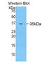 Alpha-2-Glycoprotein 1, Zinc-Binding antibody, LS-C292741, Lifespan Biosciences, Western Blot image 