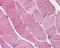 T-Box 4 antibody, 49-740, ProSci, Immunohistochemistry paraffin image 