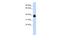 Orthopedia Homeobox antibody, A09930, Boster Biological Technology, Western Blot image 