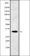 MAGE Family Member B4 antibody, orb337813, Biorbyt, Western Blot image 