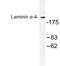 Laminin Subunit Alpha 4 antibody, LS-C177041, Lifespan Biosciences, Western Blot image 