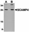 Secretory Carrier Membrane Protein 4 antibody, orb75248, Biorbyt, Western Blot image 