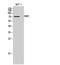 Adhesion G Protein-Coupled Receptor E2 antibody, A08546, Boster Biological Technology, Western Blot image 