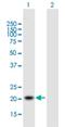 Translocase Of Inner Mitochondrial Membrane 22 antibody, H00029928-B01P, Novus Biologicals, Western Blot image 