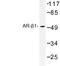 Adrenoceptor Alpha 1B antibody, LS-C176870, Lifespan Biosciences, Western Blot image 