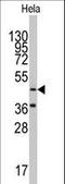 AsnRS antibody, LS-C100219, Lifespan Biosciences, Western Blot image 